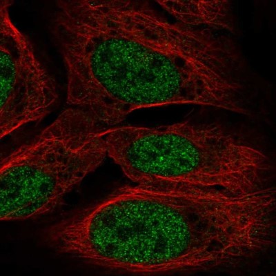 Immunocytochemistry/Immunofluorescence: TOPORS Antibody [NBP2-56069] - Staining of human cell line U-2 OS shows localization to nucleoplasm.