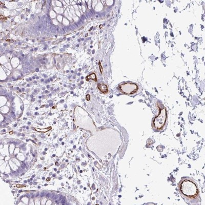 Immunohistochemistry-Paraffin: BTD Antibody [NBP2-33644] - Staining of human colon shows strong cytoplasmic positivity in endothelial cells.