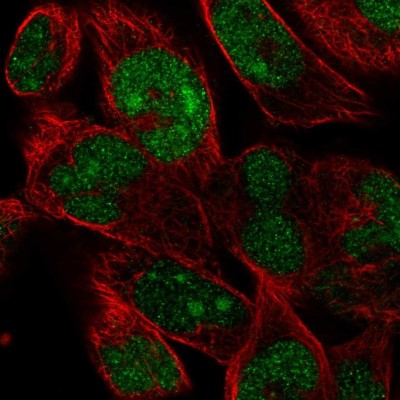 Immunocytochemistry/Immunofluorescence: FAM204A Antibody [NBP2-56149] - Staining of human cell line RH-30 shows localization to nucleus & nucleoli.