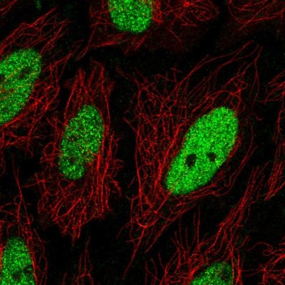 Immunocytochemistry/Immunofluorescence: C19orf57 Antibody [NBP2-56114] - Staining of human cell line SiHa shows localization to nucleoplasm.