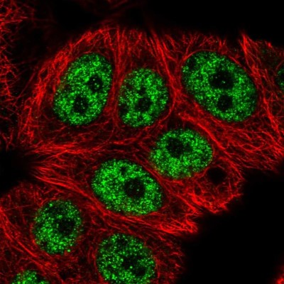 Immunocytochemistry/Immunofluorescence: RCL1 Antibody [NBP2-56056] - Staining of human cell line MCF7 shows localization to nucleoplasm.