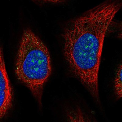 Immunocytochemistry/Immunofluorescence: URB2 Antibody [NBP2-56720] - Staining of human cell line U-2 OS shows localization to nucleoli.