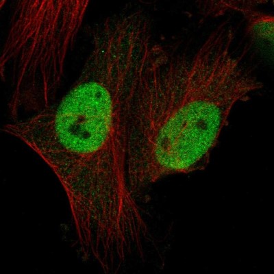 Immunocytochemistry/Immunofluorescence: CTDSPL2 Antibody [NBP2-56941] - Staining of human cell line U-251 MG shows localization to nucleoplasm.
