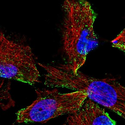 Immunocytochemistry/Immunofluorescence: HPS3 Antibody [NBP2-57010] - Staining of human cell line U-251 MG shows localization to plasma membrane.