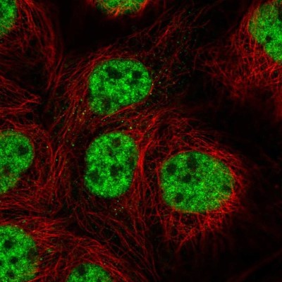 Immunocytochemistry/Immunofluorescence: csl/RBPJK Antibody [NBP2-56071] - Staining of human cell line A-431 shows localization to nucleoplasm.