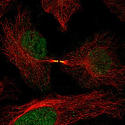 Immunocytochemistry/Immunofluorescence: FAM50B Antibody [NBP2-56015] - Staining of human cell line HeLa shows localization to nucleoplasm & cytokinetic bridge.