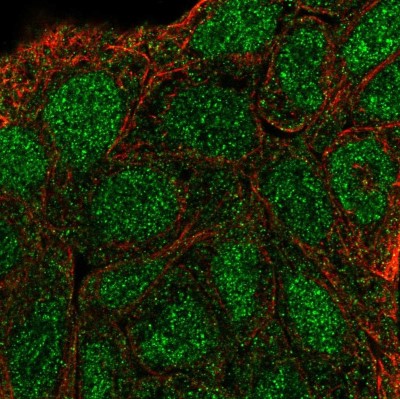 Immunocytochemistry/Immunofluorescence: SHC3 Antibody [NBP2-56058] - Staining of human cell line RT4 shows localization to nucleus & cytosol.