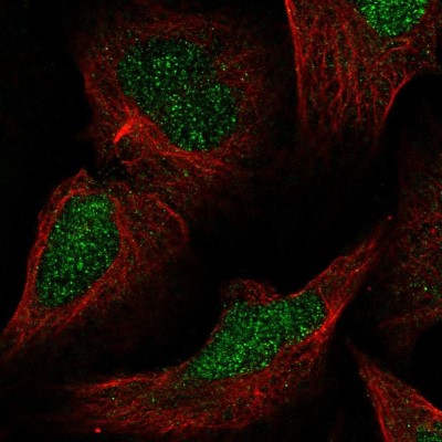 Immunocytochemistry/Immunofluorescence: MLH3 Antibody [NBP2-55958] - Staining of human cell line U-2 OS shows localization to nucleus.