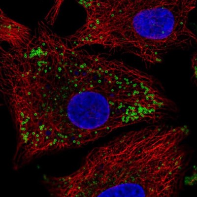 Immunocytochemistry/Immunofluorescence: KRT222 Antibody [NBP2-57205] - Staining of human cell line A549 shows localization to lipid droplets.
