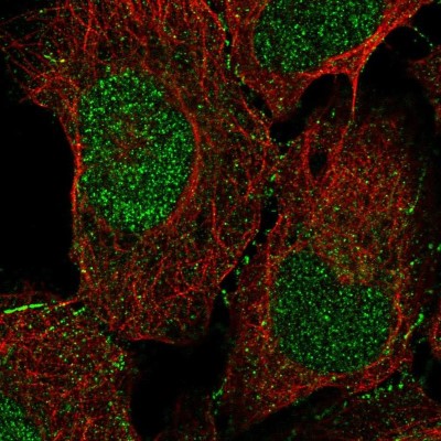 Immunocytochemistry/Immunofluorescence: Doc2-alpha Antibody [NBP2-55903] - Staining of human cell line U-2 OS shows localization to nucleus & cell junctions.