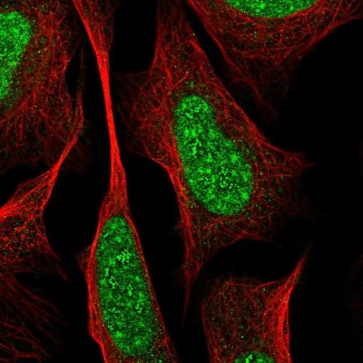 Immunocytochemistry/Immunofluorescence: RREB1 Antibody [NBP2-56824] - Staining of human cell line U-2 OS shows localization to nuclear speckles & nucleoli fibrillar center.