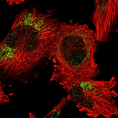 Immunocytochemistry/Immunofluorescence: ANKRD44 Antibody [NBP2-56740] - Staining of human cell line U-251 MG shows localization to mitochondria.