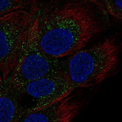 Immunocytochemistry/Immunofluorescence: GRF2 Antibody [NBP2-56592] - Staining of human cell line HaCaT shows localization to vesicles.