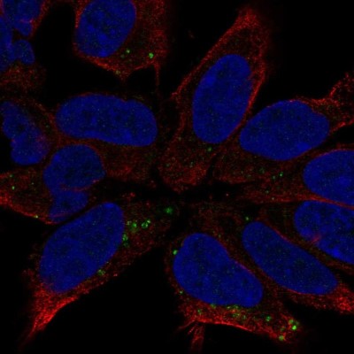 Immunocytochemistry/Immunofluorescence: DCC Antibody [NBP2-56793] - Staining of human cell line AF22 shows localization to the Golgi apparatus.