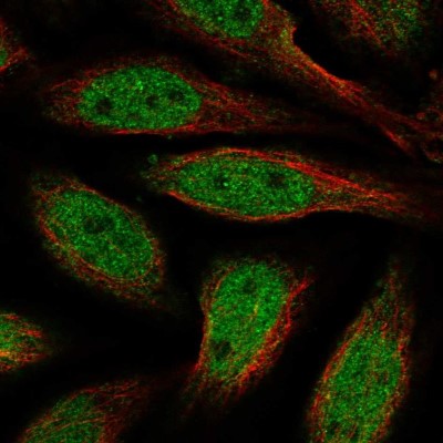 Immunocytochemistry/Immunofluorescence: ALX4 Antibody [NBP2-55644] - Staining of human cell line SiHa shows localization to nucleoplasm.