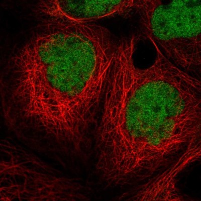 Immunocytochemistry/Immunofluorescence: MIER1 Antibody [NBP2-55642] - Staining of human cell line A-431 shows localization to nucleoplasm.