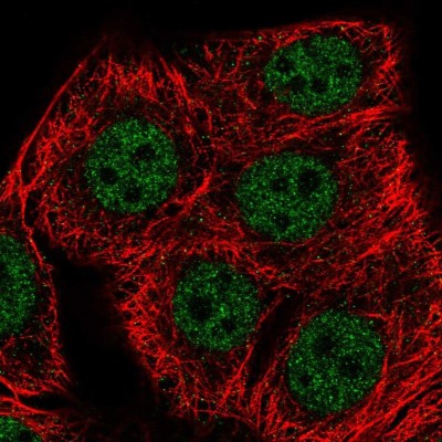 Immunocytochemistry/Immunofluorescence: SET1B Antibody [NBP2-55848] - Staining of human cell line MCF7 shows localization to nucleoplasm.