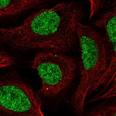 Immunocytochemistry/Immunofluorescence: CCDC12 Antibody [NBP2-55891] - Staining of human cell line U-2 OS shows localization to nucleoplasm.