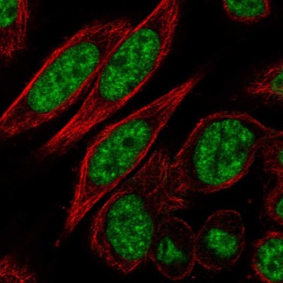 Immunocytochemistry/Immunofluorescence: CDC2L2 Antibody [NBP2-57971] - Staining of human cell line SiHa shows localization to nuclear speckles.