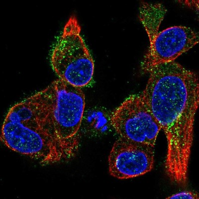 Immunocytochemistry/Immunofluorescence: KiSS1R/GPR54 Antibody [NBP2-57942] - Staining of human cell line Hep G2 shows localization to plasma membrane & vesicles.