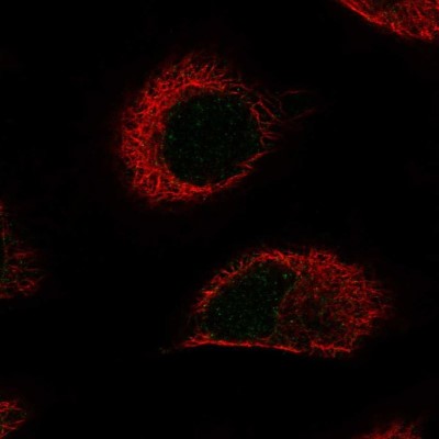 Immunocytochemistry/Immunofluorescence: FA2H Antibody [NBP2-58016] - Staining of human cell line A549 shows localization to nuclear membrane.