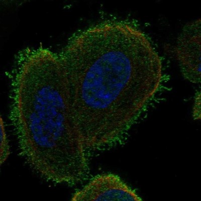 Immunocytochemistry/Immunofluorescence: C14orf37 Antibody [NBP2-55607] - Staining of human cell line PC-3 shows localization to plasma membrane.
