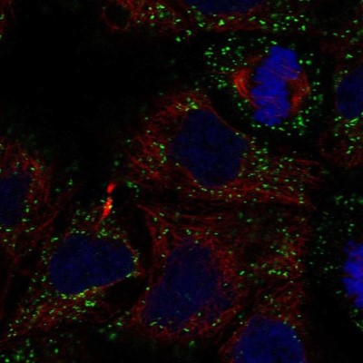 Immunocytochemistry/Immunofluorescence: GLTPD2 Antibody [NBP2-55716] - Staining of human cell line CACO-2 shows localization to vesicles.