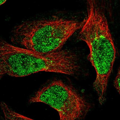 Immunocytochemistry/Immunofluorescence: NUDT18 Antibody [NBP2-56146] - Staining of human cell line U-2 OS shows localization to nucleoplasm & the Golgi apparatus.