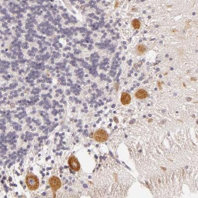 Immunohistochemistry: C14orf37 Antibody [NBP1-86526] - Staining of human cerebellum shows strong cytoplasmic positivity in purkinje cells.