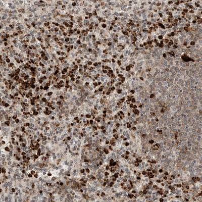 Immunohistochemistry: Nucleoporin 107 Antibody [NBP1-82513] - Staining of human spleen shows strong cytoplasmic and nuclear positivity in cells in red pulp.