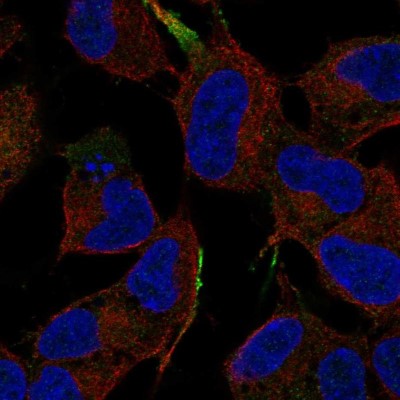 Immunocytochemistry/Immunofluorescence: JIP1 Antibody [NBP2-56324] - Staining of human cell line SH-SY5Y shows localization to plasma membrane.