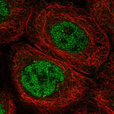 Immunocytochemistry/Immunofluorescence: Artemis Antibody [NBP2-56362] - Staining of human cell line A-431 shows localization to nucleoplasm & the Golgi apparatus.