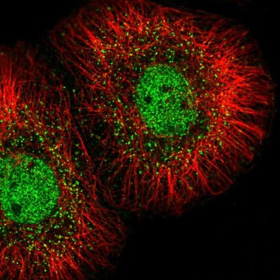 Immunocytochemistry/Immunofluorescence: MED23 Antibody [NBP2-56372] - Staining of human cell line HaCaT shows localization to nucleoplasm & vesicles.