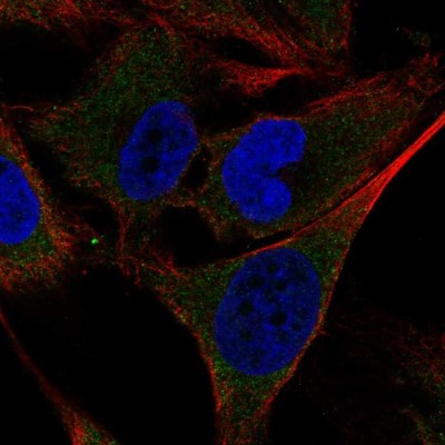 Immunocytochemistry/Immunofluorescence: SHC4 Antibody [NBP2-56379] - Staining of human cell line SK-MEL-30 shows localization to cytosol.