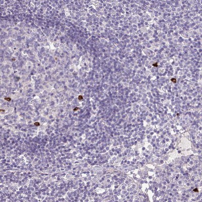 Immunohistochemistry-Paraffin: CXorf66 Antibody [NBP2-13888] Staining of human lymph node shows strong positivity in a subset of leukocytes.