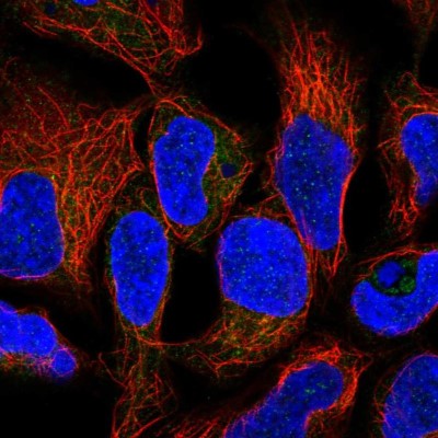 Immunocytochemistry/Immunofluorescence: RNF5 Antibody [NBP2-57712] - Staining of human cell line HEK 293 shows localization to endoplasmic reticulum.