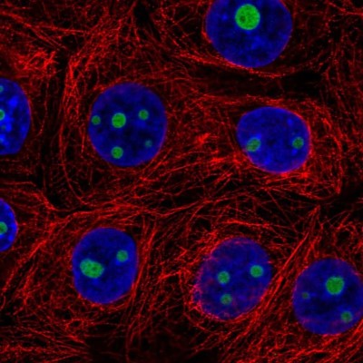 Immunocytochemistry/Immunofluorescence: SERTAD3 Antibody [NBP2-57666] - Staining of human cell line MCF7 shows localization to nucleoli.