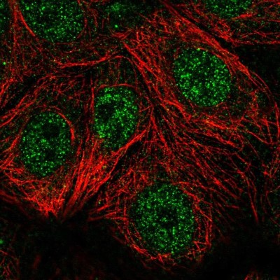 Immunocytochemistry/Immunofluorescence: TSPAN17 Antibody [NBP2-57551] - Staining of human cell line MCF7 shows localization to nucleoplasm.