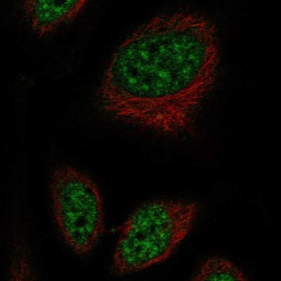 Immunocytochemistry/Immunofluorescence: RFPL2 Antibody [NBP2-57626] - Staining of human cell line SiHa shows localization to nuclear speckles.