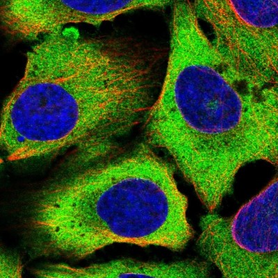 Immunocytochemistry/Immunofluorescence: Eukaryotic translation initiation factor 5B Antibody [NBP2-55202] - Staining of human cell line U-2 OS shows localization to plasma membrane & cytosol.