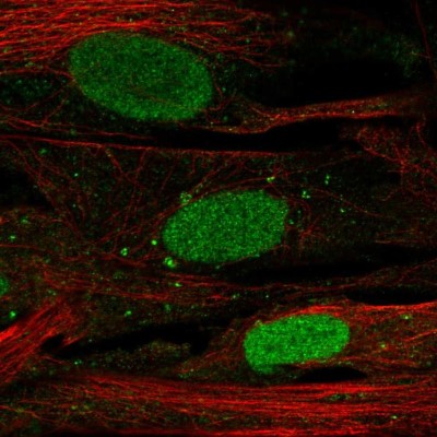 Immunocytochemistry/Immunofluorescence: SHOX Antibody [NBP2-55181] - Staining of human cell line BJ shows localization to nucleoplasm & vesicles.