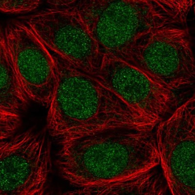 Immunocytochemistry/Immunofluorescence: CDC73/HRPT2 Antibody [NBP2-55257] - Staining of human cell line MCF7 shows localization to nucleus.