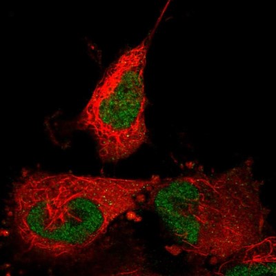 Immunocytochemistry/Immunofluorescence: ABTB2 Antibody [NBP2-55198] - Staining of human cell line U-251 MG shows localization to nucleoplasm.