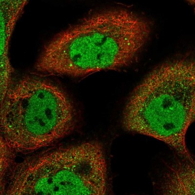 Immunocytochemistry/Immunofluorescence: ARMC8 Antibody [NBP2-55188] - Staining of human cell line A-431 shows localization to nucleoplasm & vesicles.