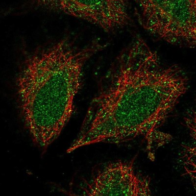 Immunocytochemistry/Immunofluorescence: CCDC122 Antibody [NBP2-54949] - Staining of human cell line SiHa shows localization to nucleus & vesicles.