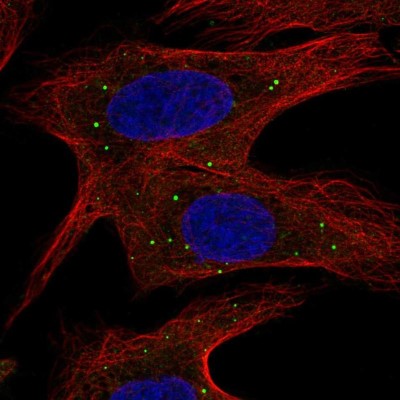 Immunocytochemistry/Immunofluorescence: ABCB9 Antibody [NBP2-55166] - Staining of human cell line U-2 OS shows localization to vesicles.