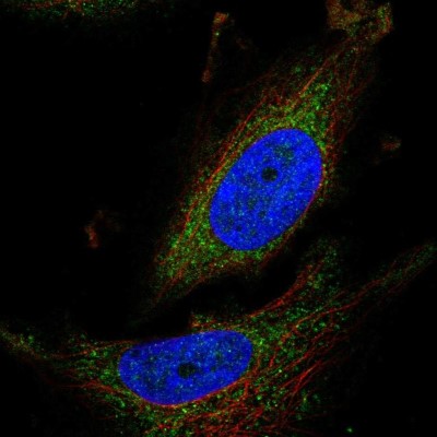 Immunocytochemistry/Immunofluorescence: ATPAF1 Antibody [NBP2-55035] - Staining of human cell line SiHa shows localization to mitochondria.