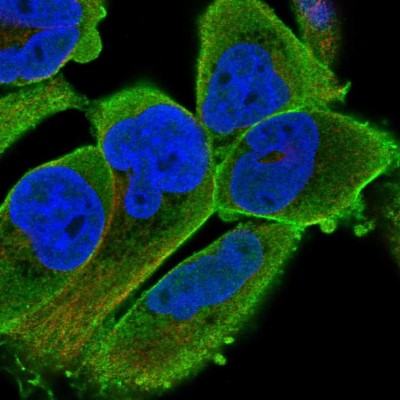 Immunocytochemistry/Immunofluorescence: PALMD Antibody [NBP2-55156] - Staining of human cell line RH-30 shows localization to plasma membrane & actin filaments.