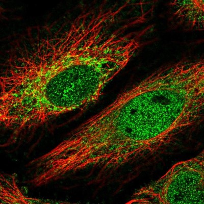 Immunocytochemistry/Immunofluorescence: HKR1 Antibody [NBP2-55167] - Staining of human cell line HeLa shows localization to nucleoplasm & mitochondria.