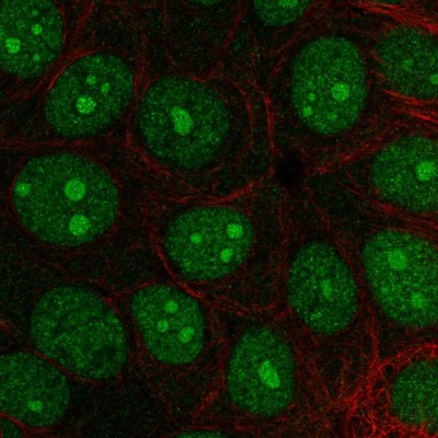 Immunocytochemistry/Immunofluorescence: INT3 Antibody [NBP2-57633] - Staining of human cell line MCF7 shows localization to nucleus & nucleoli.